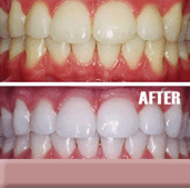 Dental Cosmetics Corner Banner